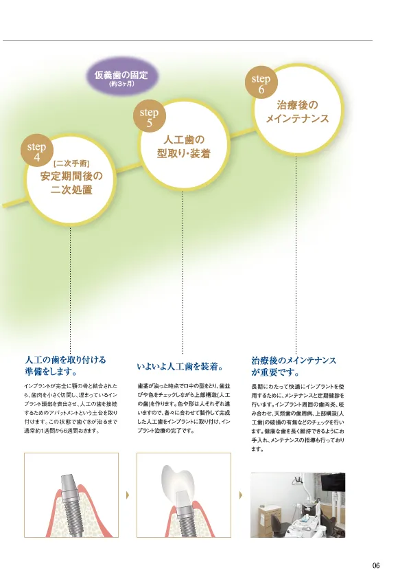 資料「インプラント治療の流れ」誌面（右ページ）